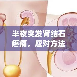 半夜突发肾结石疼痛，应对方法、预防策略全解析